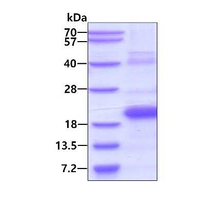 SDS-Page: Recombinant Human TR2IT1 His Protein [NBP2-22861] - 3ug by SDS-PAGE under reducing condition and visualized by coomassie blue stain.